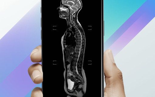 FoundersCard x Prenuvo: The Future of Preventative Health